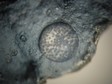 hyalite