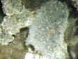 m�cle_de_marburg
